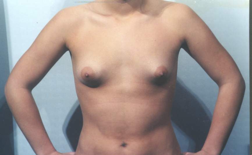 Голенькая грудь нулевого размера