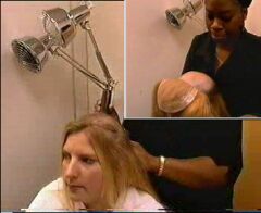 The lady to be seen has suffered from partial hairloss shave bald spot on her head and attach hairpiece to cover the bald part of her head. After this treatment she is astonished to see how good she looks now.