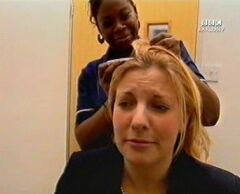 The lady who suffered from partial hairloss taking off her hairpiece and attach a new one.